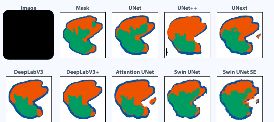 Tissue segmentation results of different models on a wound image